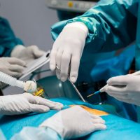 General Surgery